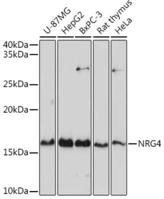 Western Blot: NRG4 AntibodyAzide and BSA Free [NBP2-93954]